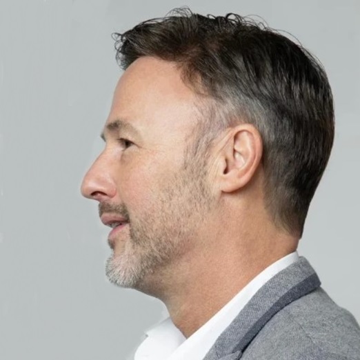hair system transformations in lincolnshire